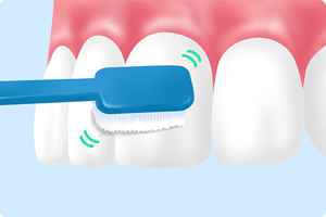 ブラッシング指導